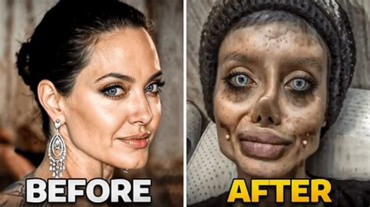 
Did Steve-O Get A Plastic Surgery? The 48-year-old Star Shocking Revealed His Keen To Go Under The Knife 